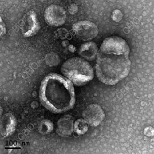 外泌体透射电镜图